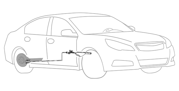 Ball Joint Replacement